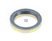 Tesnici krouzek, hridel vacky brzdy DT Spare Parts 1.18233